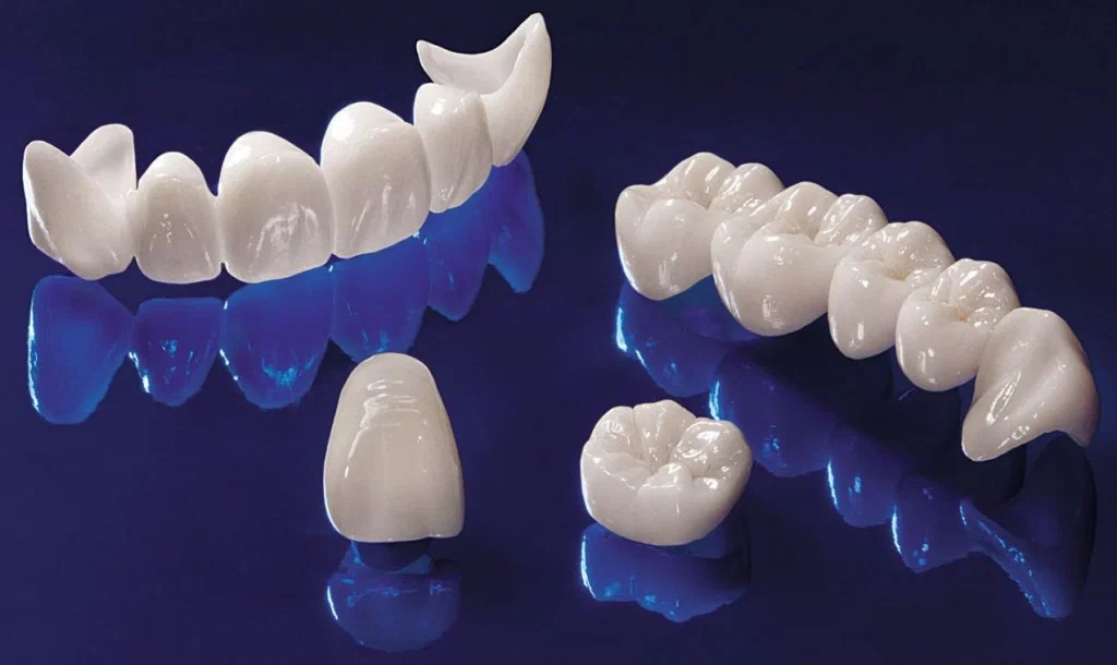 طربوش الاسنان - GEMS Dental Clinic