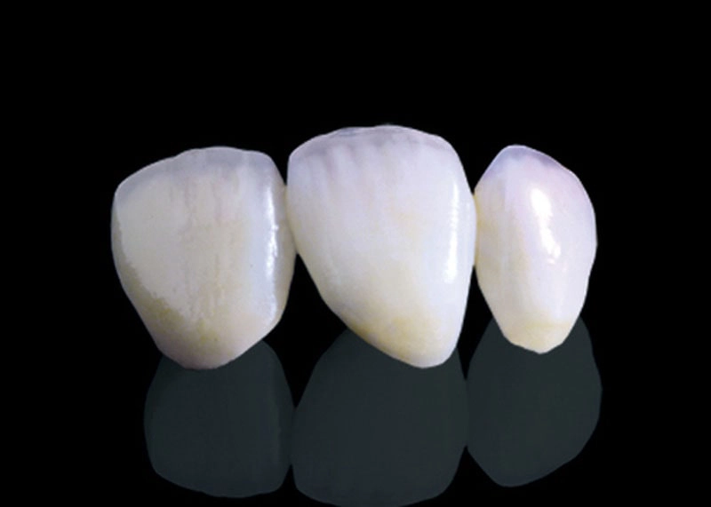 أنواع طرابيش الأسنان واسعارها