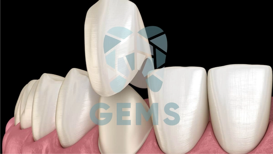 الفرق بين الطربوش البورسلين والزيركون-GEMS Dental Clinic