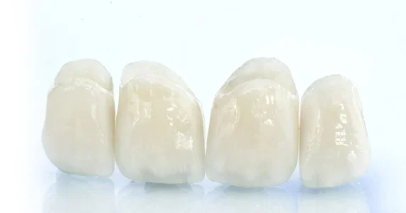 سعر الطربوش الزركونيوم- GEMS Dental Clinic