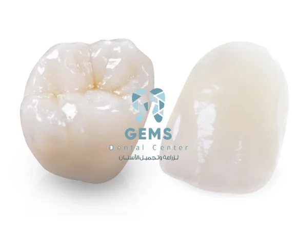 تلبيسة emax سعر مصر