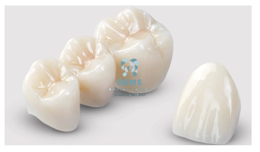 تلبيسة emax سعر مصر