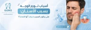 أسباب تورم الوجه بسبب الأسنان_ متى يكون السبب خراجًا أو التهابًا؟