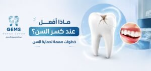 ماذا أفعل عند كسر السن