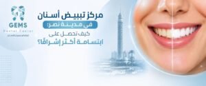 مركز تبييض أسنان في مدينة نصر